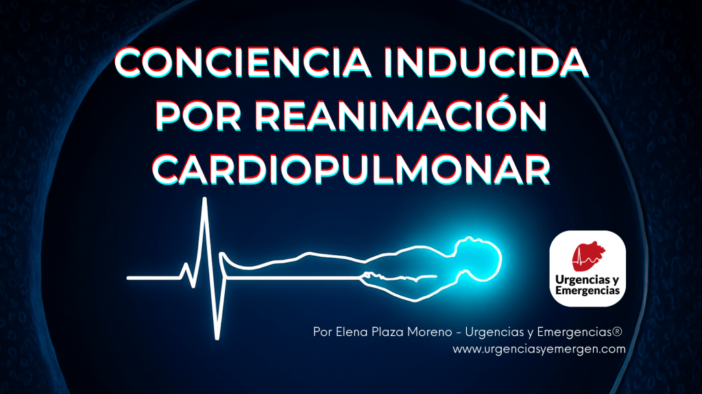 Conciencia inducida por reanimación cardiopulmonar.