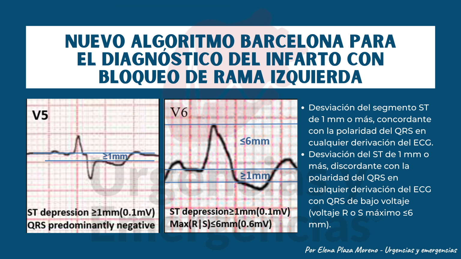 Algoritmo Barcelona: diagnóstico de IAM con bloqueo de rama izq