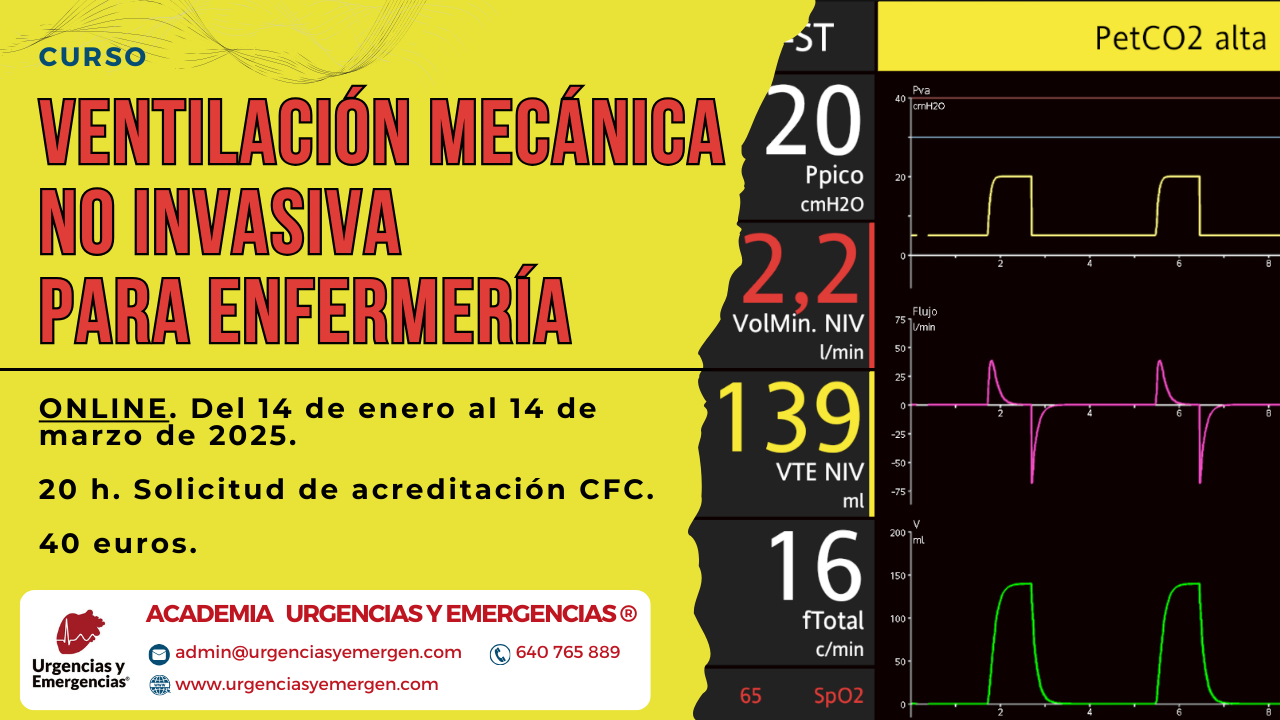 Curso ventilación mecánica no invasiva para enfermería