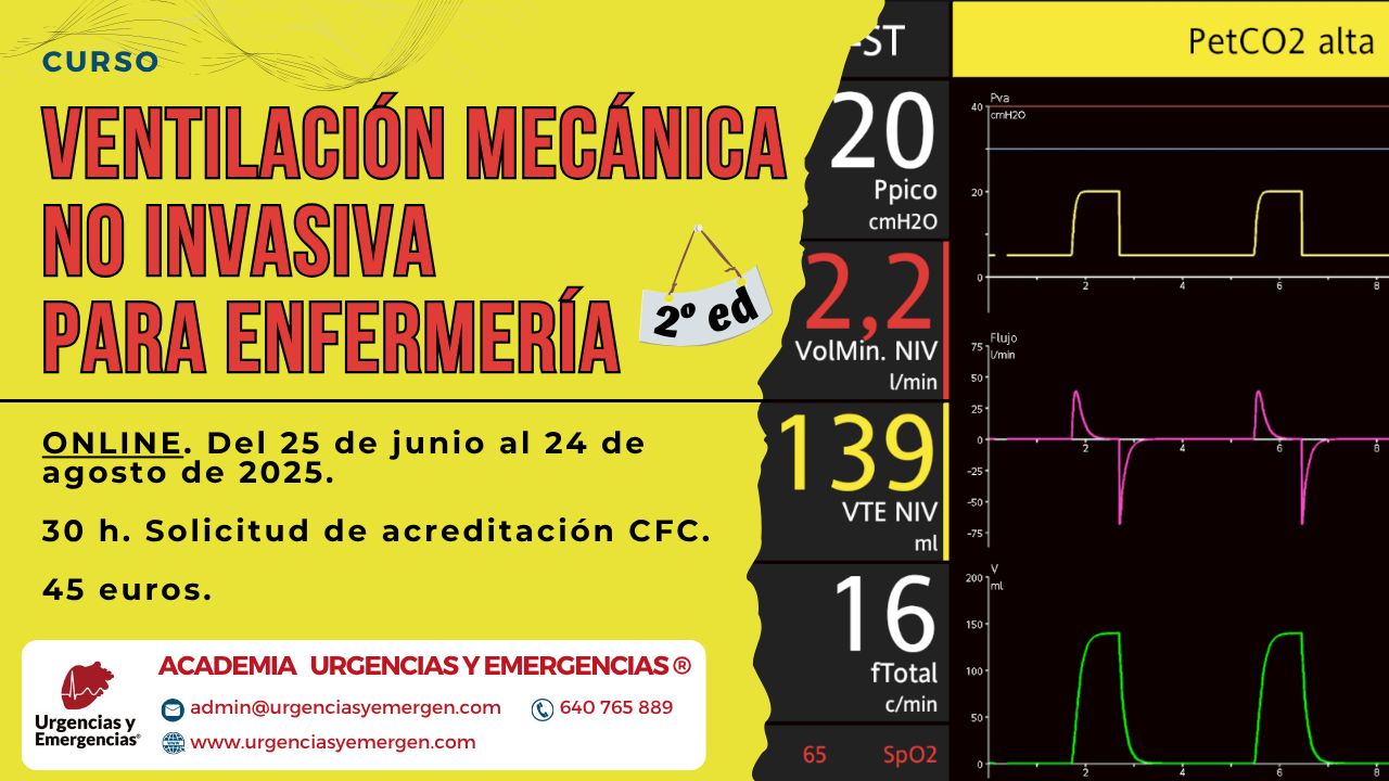 Curso VMNI para enfermería Ventilación mecánica no invasiva