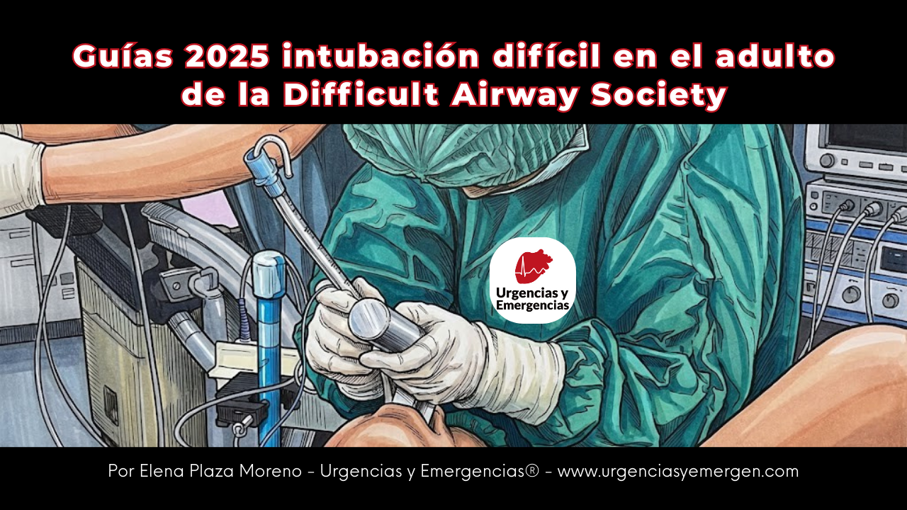 Guías intubación difícil adulto DAS 2025